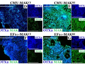Evaluation of MAK isoforms in patient-derived photoreceptor precursors.